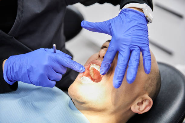 Best Emergency Dentist for Lost Fillings or Crowns in Santa Clara, UT